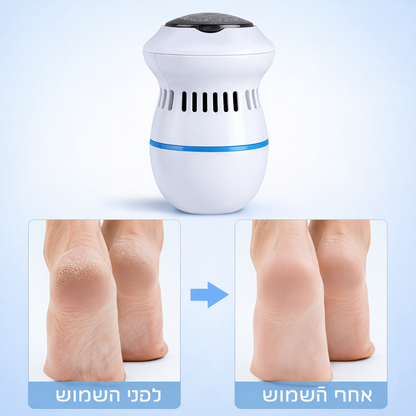 מכשיר חשמלי להסרת יבלות בכפות הרגליים Pedelux™